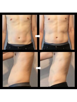 伊達男/フォースカッター 事例