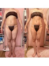 ポノ(Pono)/【痩身】最新ビフォーアフター