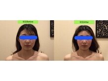 アジール 長岡リバーサイド千秋店(agir)/before/after画像