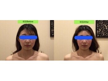 アジール 長岡リバーサイド千秋店(agir)/before/after画像