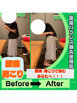 富雄バランス鍼灸接骨院/【腰痛の方の施術後】