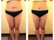 バービーホリック(barbie holic)/１３０分コース　初回と３回目