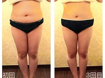 バービーホリック(barbie holic)/１３０分コース　初回と３回目