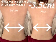 サロン アイリス(salon iRiS)の雰囲気（痩身/ダイエットはお任せ！ブライダルにもオススメです！）