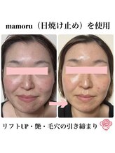 ケンビラク(Kenbiraku 健美楽)/リフトUP・艶・毛穴引き締まり