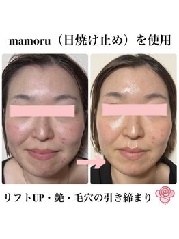 ケンビラク(Kenbiraku 健美楽)/リフトUP・艶・毛穴引き締まり