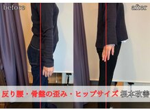 バキバキしない本格矯正で、姿勢・体型のお悩みを根本から改善