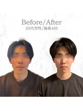 ルーツ 武蔵小杉(R∞ts)/衝撃のビフォーアフター