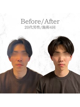 ルーツ 武蔵小杉(R∞ts)/衝撃のビフォーアフター