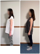 ステラ 武蔵小杉(Stella)/美骨エステ B/A