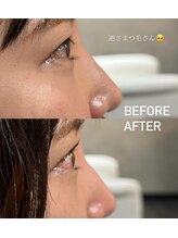 ウェヌス アイ ビューティ(VENUS eye beauty)/ラッシュリフト