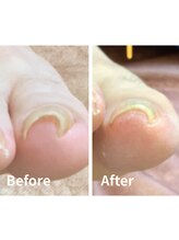 リゼラアンドコー 相模大野店/ドイツ式フットケア専門店