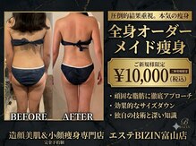エステビジン 富山店(エステBIZIN)