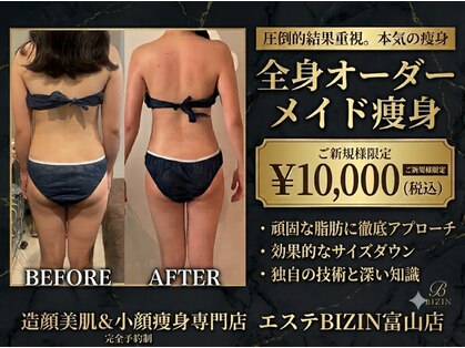 エステビジン 富山店(エステBIZIN)の写真