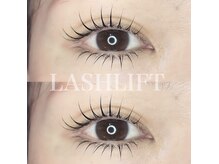 種類豊富なデザインからお客様に似合うものを提案致します♪