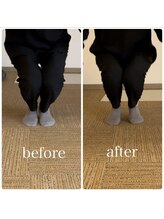 ラウム(raum.)/施術（ストレッチ有）での変化