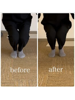 ラウム(raum.)/施術（ストレッチ有）での変化