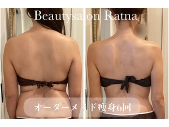 ラトナ(Ratna)/6回オーダーメイド痩身