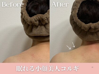 セレソル(CERESOL)の写真