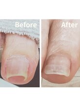 リゼラアンドコー 相模大野店/ドイツ式フットケア専門店