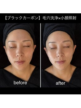 シスリー(CICELY)/『最新ブラックピーリング』