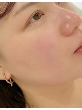 ソイ(soi.)/フェイスWax+次世代まつ毛パーマ