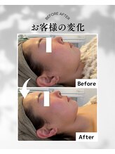 エムボーテ 太田店(M BEAUTE33)/顔筋小顔コルギ