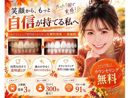 LBSホワイトニング 上野店の写真