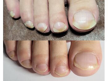 阿良波々岐(アラハバキ)/70分フットケア￥9300