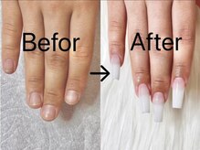 爪の悩みがある方もお任せください♪