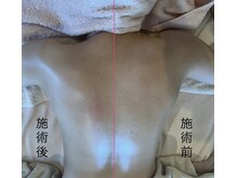 プリンセス アール(Princess R)/巻き肩は首、肩凝りの原因に