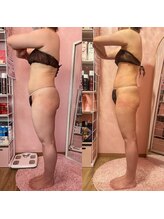 ポノ(Pono)/【痩身】必ず痩せた！と言われる