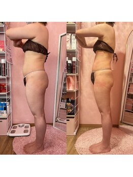 ポノ(Pono)/【痩身】必ず痩せた!と言われる