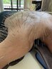 【オーダーメイド施術】ルート鍼施術　45分　¥15,000→¥12,000