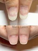 マリーロール 梅田店(Marie Laure)/深爪矯正/自爪育成/自爪風