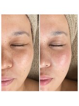 メイン(main)/★before after★