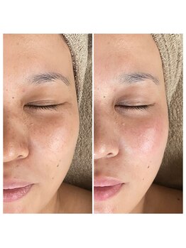 メイン(main)/★before after★