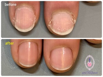 ネイルケア&爪磨き