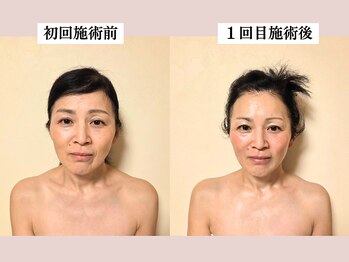 骨から変えるたるみケアサロン Ola【オラ】/