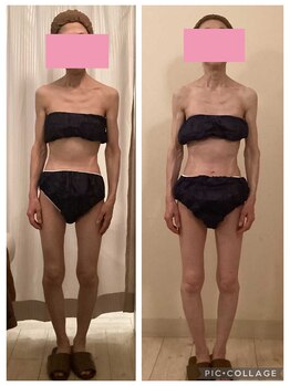 小顔コルギ専門店 フェルーシュ 成田駅前店(Feruche)/背中+小顔コルギ 結果写真