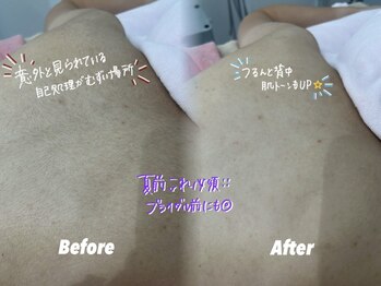 クイーン 渋谷店(QUEEN)/剃るだけで肌が明るくなる