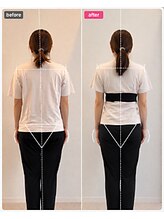 ホリック アイス コア ボディ(HOLIC ICE CORE BODY)/6ヶ月の変化