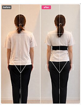 ホリック アイス コア ボディ(HOLIC ICE CORE BODY)/6ヶ月の変化