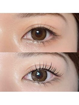 イール(ER)/before→after