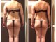 ユジュ(yju)の写真/地域No.1のメニュー数で部分～全身引き締めができる本気の痩身☆今ならモニター価格でお得にダイエット◎