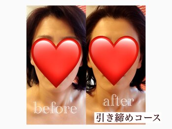 アエラ(AERA)/フェイシャル【引き締めコース】