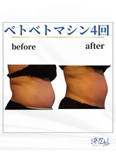 デール(R:DeeL)/ベトベトマシーン