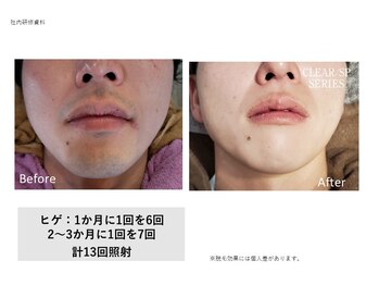 フェレザ 新潟(Felleza)/シェービング卒業への近道