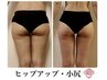 塗るキャビテーション！？炭酸ローションでキュッと引き締め♪下半身集中50分