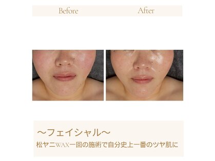 パーソナル ユニ(uni)の写真